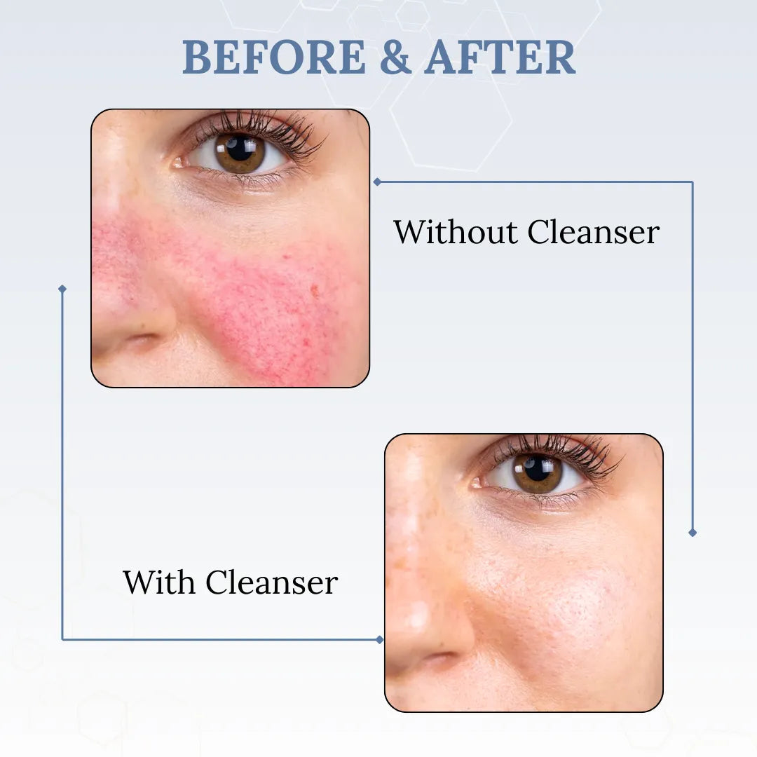 Skinaa Hydrating Gentle Face Cleanser | Soap-Free Formula for Sensitive Skin | 100g
