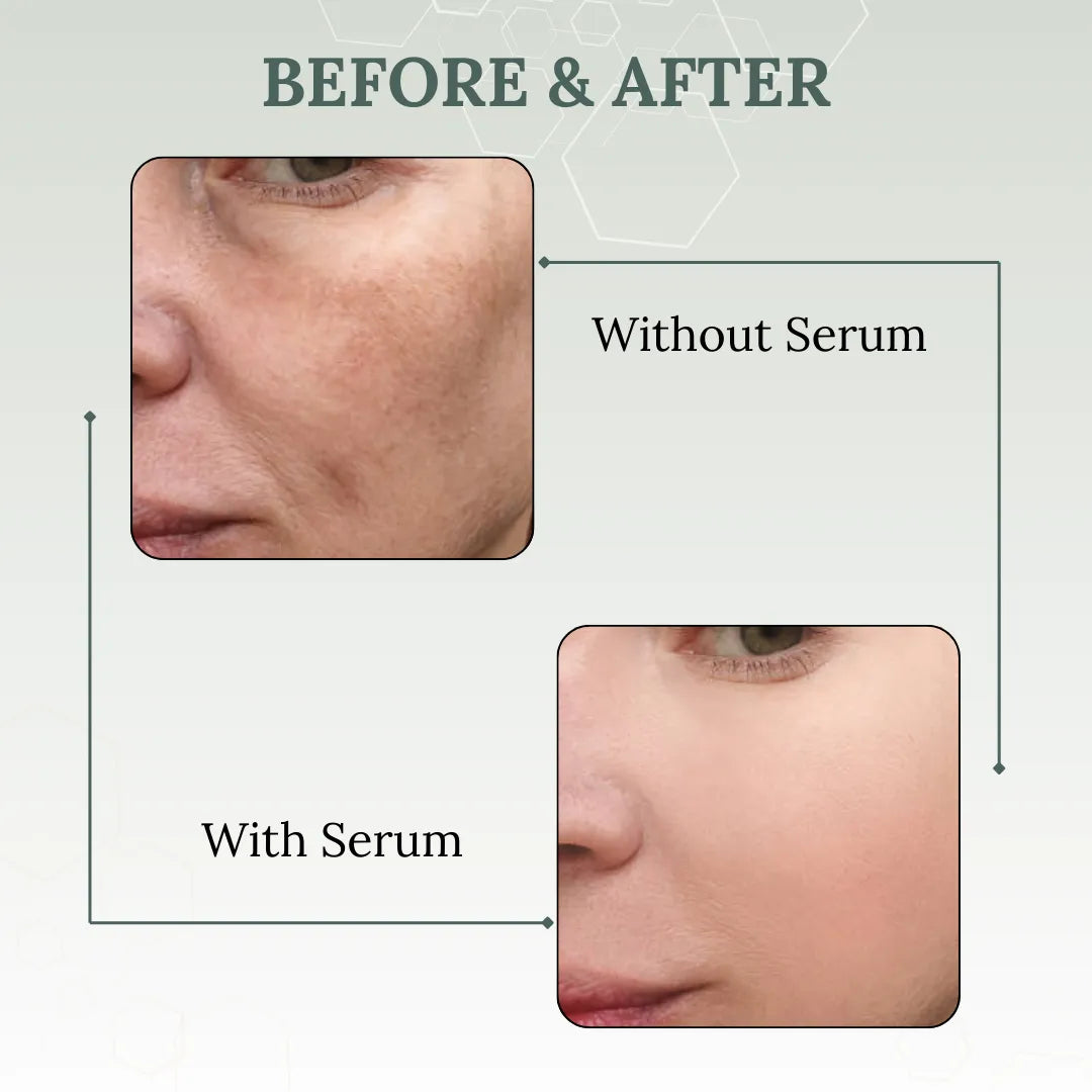 Skinaa Vitamin C Serum 15% | Brightening & Anti-Aging Face Serum for Glowing Skin | 30 ml