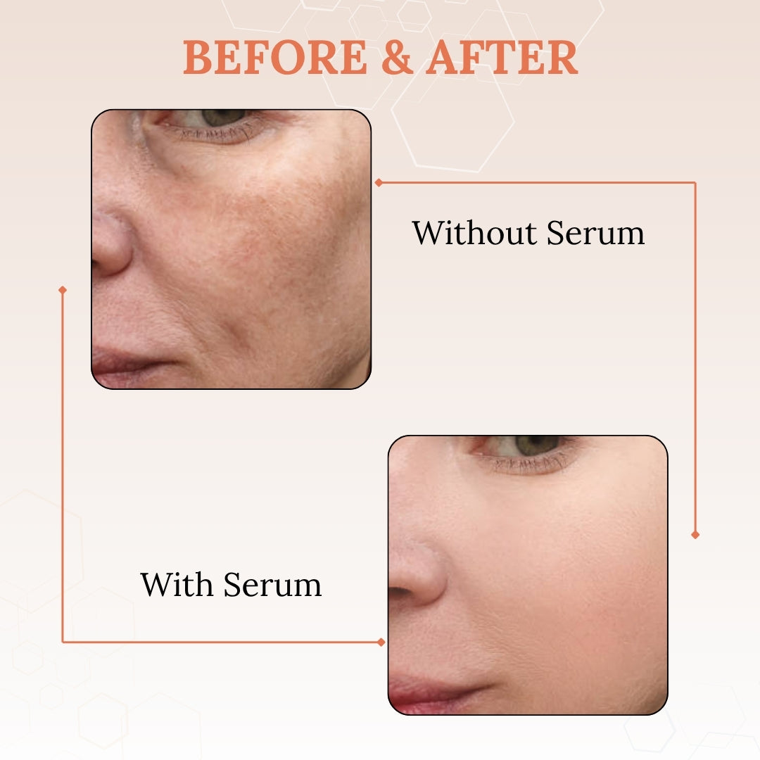 Skinaa Vitamin C Serum 15% | Brightening & Anti-Aging Face Serum for Glowing Skin | 30 ml