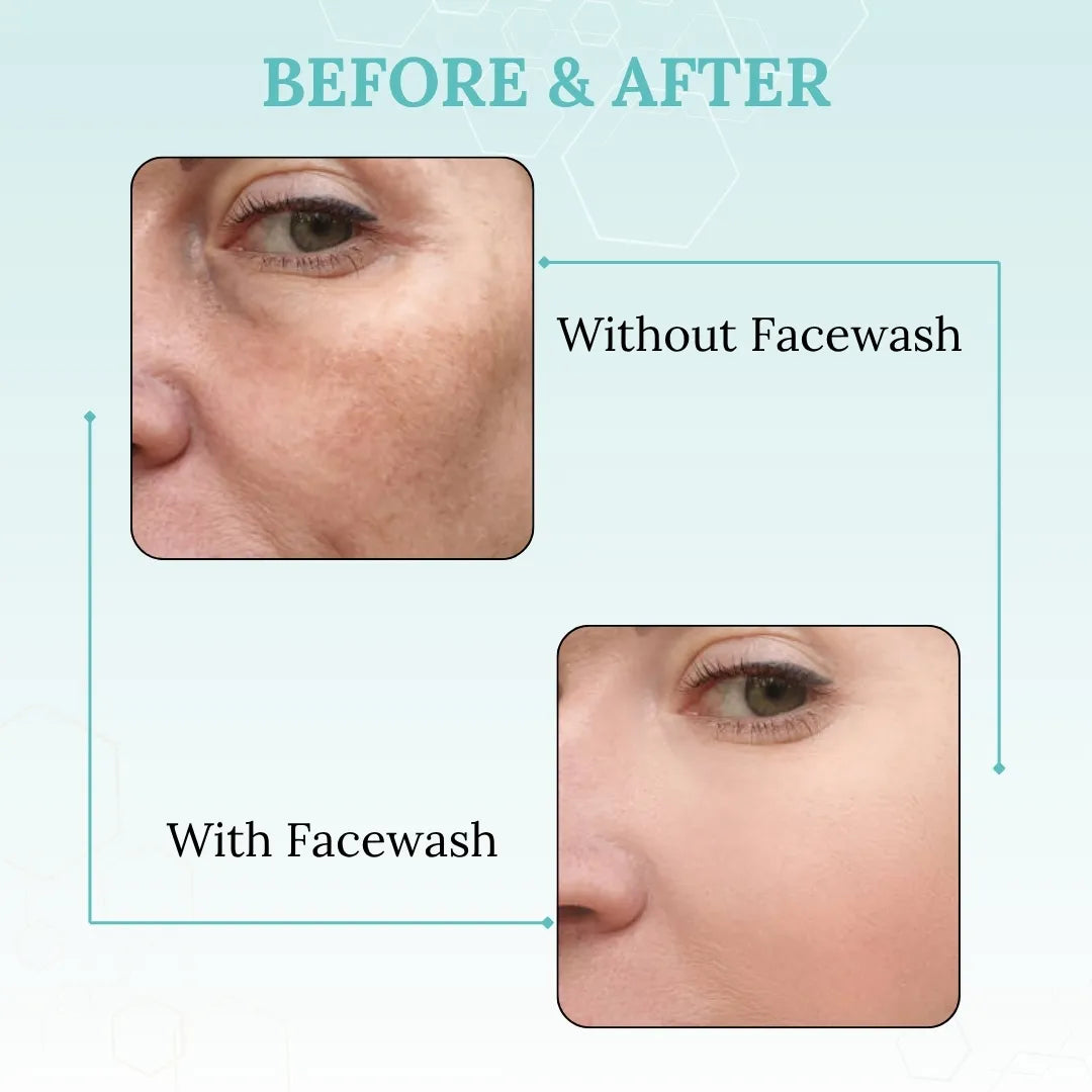 Before and after comparison of face with and without facewash on a light blue background