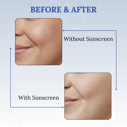 Before and after comparison of skin with and without Skinaa Aqua sunscreen on a light blue background.