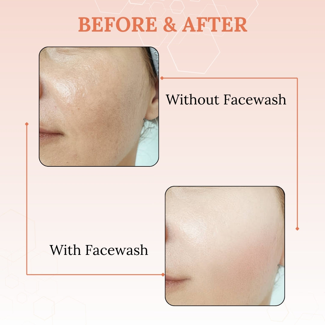 Skinaa Vitamin C Face Wash for Instant Skin Brightening | 100ml