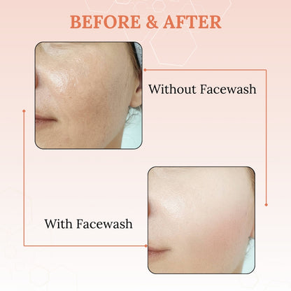 Skinaa Vitamin C Face Wash for Instant Skin Brightening | 100ml